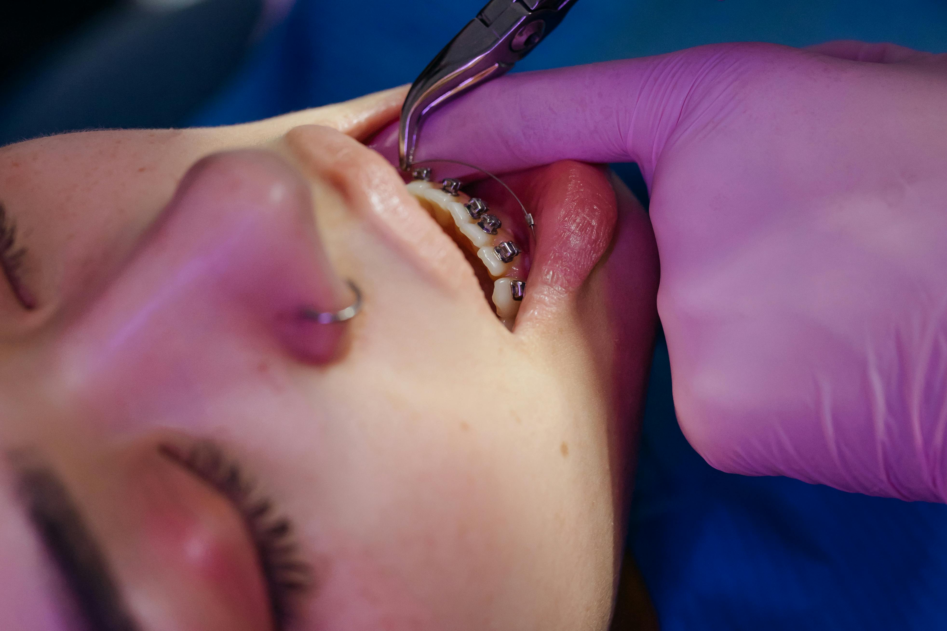 Trusted Dental Check Up Singapore – Book Today!