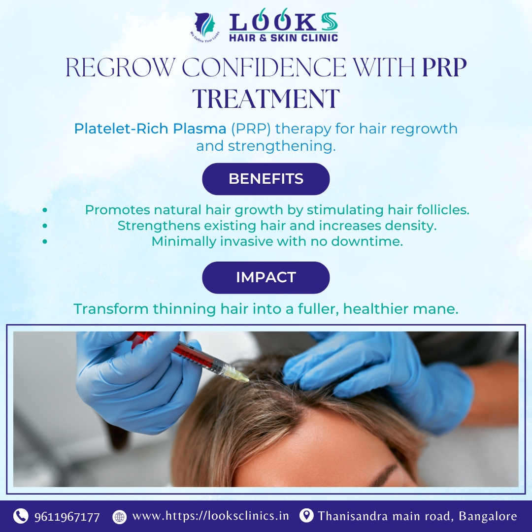 PRP Hair Treatment in Bangalore